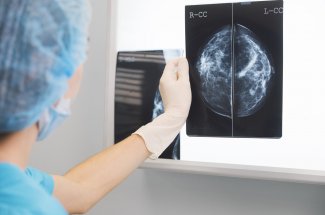 Atteinte d’un cancer, elle subit 20 seances de radiotherapie dans le mauvais sein