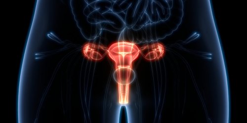 Quelle est la difference entre l’endometriose et le cancer de l’endometre ?
