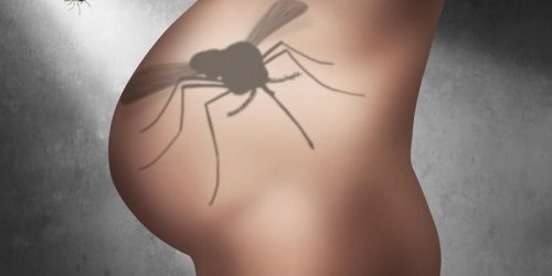 Pourquoi le virus Zika est responsable de microcephalie ?