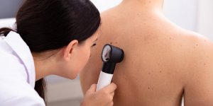 Cancer de la peau : l’ANSM suspend la mise sur le marche du gel Picato