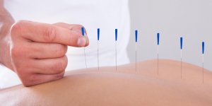Cervicarthrose : le deroulement d-une seance d-acupuncture