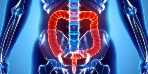Diverticule du colon : la definition