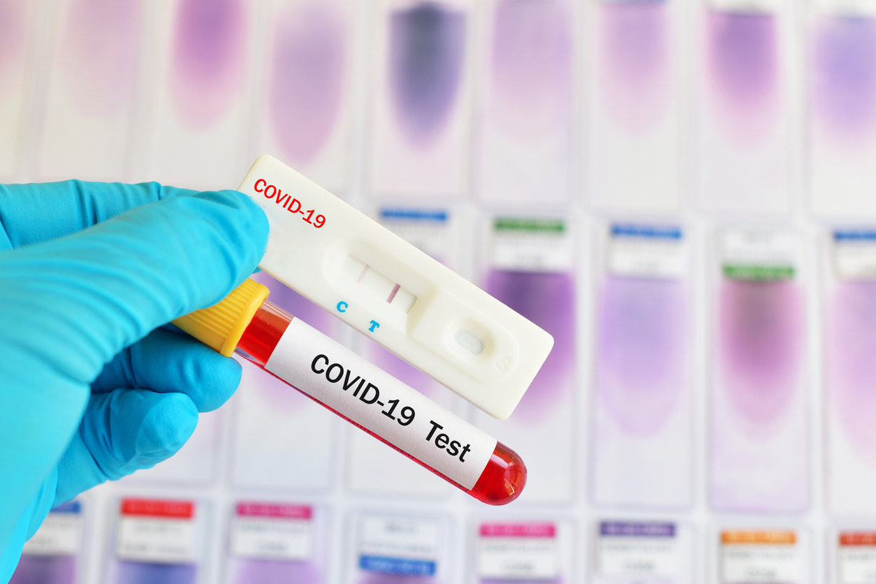 Coronavirus Les Nouveaux Tests Rapides C Est Quoi