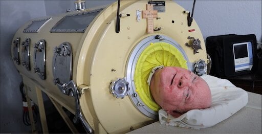 The man who lived in an “iron lung” is dead