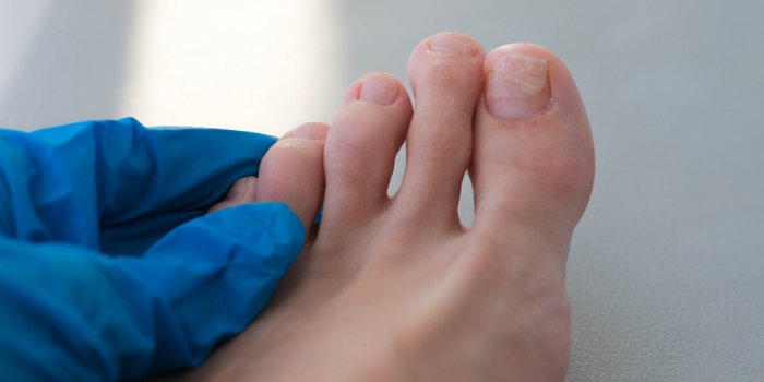 Pieds : 7 choses essentielles Ã  faire une fois dÃ©chaussÃ©