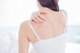 Eczema (ou dermatite allergique) de contact : symptomes et traitements pour le soigner