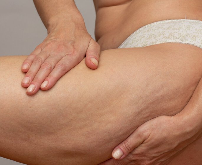 5 exercices anti cellulite pour les quinquas et plus ! 