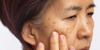 3 effets inattendus de la menopause sur votre peau (et ce n-est pas les rides !)