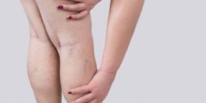 Syndrome des jambes sans repos : ce medicament n-est pas recommande selon ce medecin