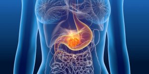 Cancer de l’estomac : 8 signes precurseurs qui doivent alerter