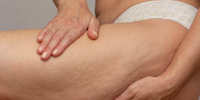 cropped woman body with hands on leg pressing skin to show cellulite over gray background