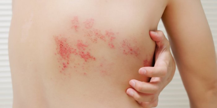 Toux allergique : voici les 4 symptômes qui doivent vous alerter