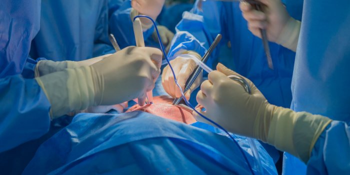 doctors team wear blue coat perform heart surgery at the operating room in the hospital