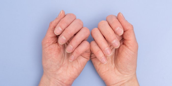 psoriasis, maladies ongles, mycose