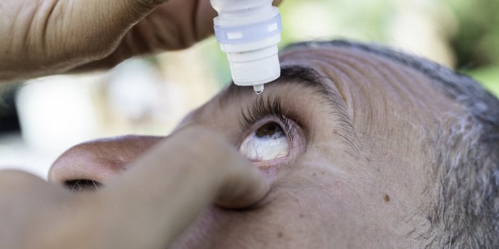 man putting eye drops in an irritated eyevision, irritated eye, blood vessels in the sclera