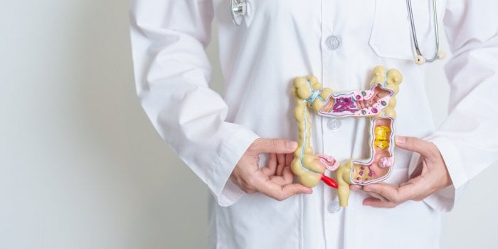 doctor holding human colon anatomy model colonic disease, large intestine, colorectal cancer, ulcerative colitis, diverti...