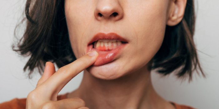 close up shot of gum inflammation cropped shot of a young woman showing red bleeding gums isolated on a gray background d...