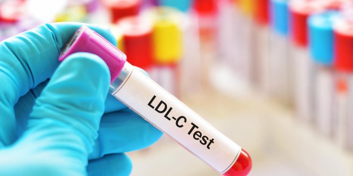 Cholestérol LDL bas : y a-t-il des risques ?