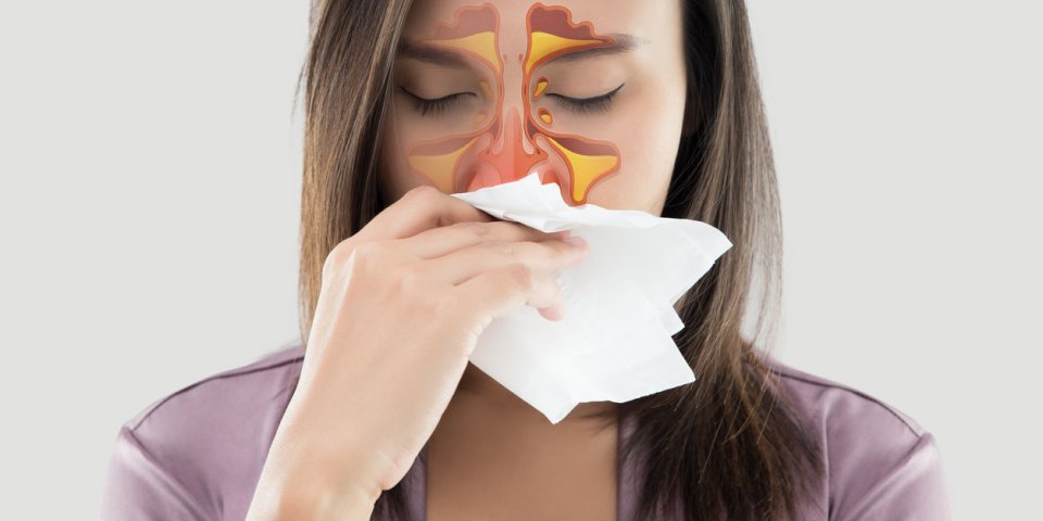 Sinusite : symptômes, causes, traitement et prévention