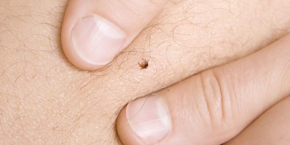 Maladie De Lyme Reconnaitre La Lesion Typique De L Infection